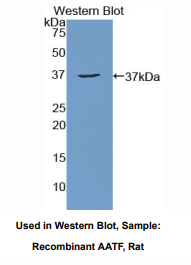 https://msimg.bioon.com/bionline/goods-no-pic.png