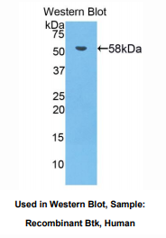 人布鲁东氏酪氨酸激酶(Btk)多克隆抗体