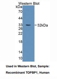 人拓扑异构酶Ⅱ结合蛋白1(TOPBP1)多克隆抗体