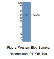 https://msimg.bioon.com/bionline/goods-no-pic.png