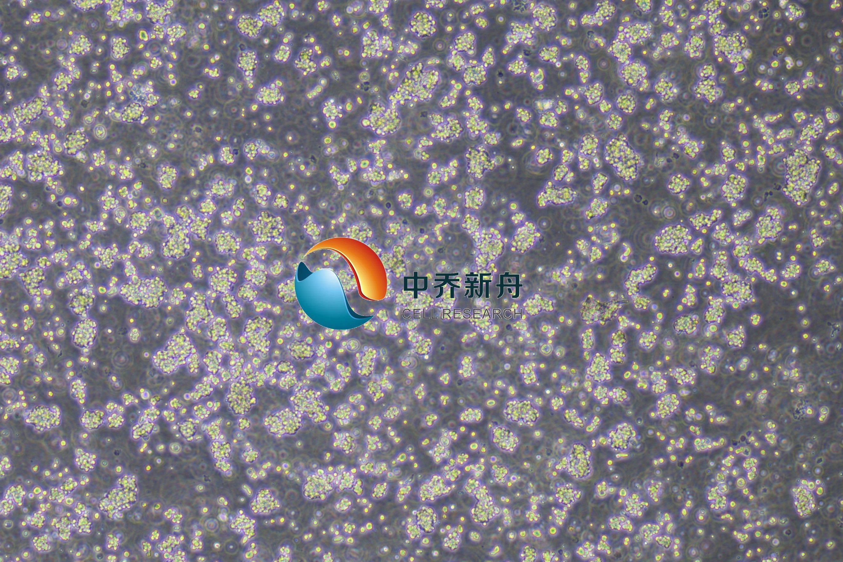 https://img.medsci.cn/8eee53bbc4cb7a98de615e72115896bc4e27fda5cbb764dbd67d9d641c2bb46a.png