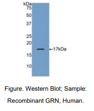 https://msimg.bioon.com/bionline/goods-no-pic.png