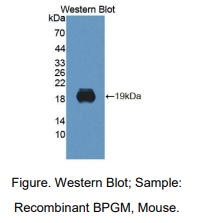 https://msimg.bioon.com/bionline/goods-no-pic.png