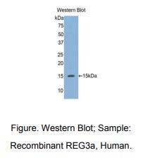 人再生胰岛衍生蛋白3α(REG3a)多克隆抗体