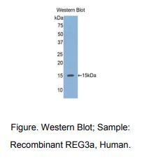 https://msimg.bioon.com/bionline/goods-no-pic.png