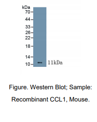 https://msimg.bioon.com/bionline/goods-no-pic.png