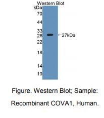 人细胞内卵巢癌抗原1(COVA1)多克隆抗体