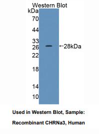 人烟碱型胆碱受体α3(CHRNa3)多克隆抗体