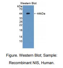 人钠碘运输蛋白(NIS)多克隆抗体