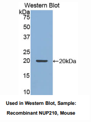 https://msimg.bioon.com/bionline/goods-no-pic.png