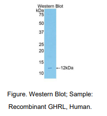 https://msimg.bioon.com/bionline/goods-no-pic.png