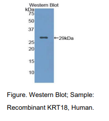 https://msimg.bioon.com/bionline/goods-no-pic.png