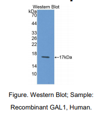 https://msimg.bioon.com/bionline/goods-no-pic.png