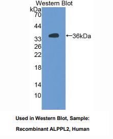 https://msimg.bioon.com/bionline/goods-no-pic.png