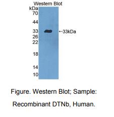 人异连蛋白β(DTNb)多克隆抗体