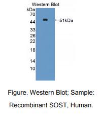 https://msimg.bioon.com/bionline/goods-no-pic.png