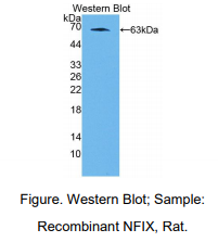 大鼠核因子I/X(NFIX)多克隆抗体