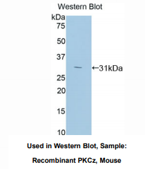 https://msimg.bioon.com/bionline/goods-no-pic.png