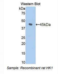大鼠己糖激酶1(HK1)多克隆抗体