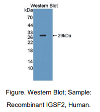 https://msimg.bioon.com/bionline/goods-no-pic.png