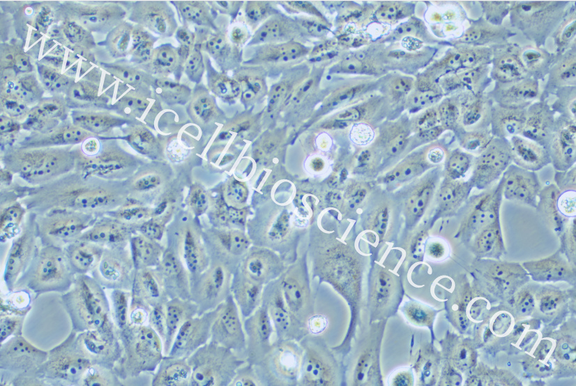 KMH-2细胞/KMH2细胞/KMH-2/KMH2/人甲状腺癌细胞（未分化）