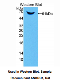大鼠锚定蛋白重复域蛋白1(ANKRD1)多克隆抗体