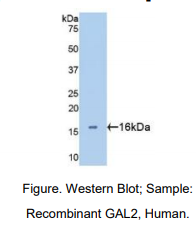 人半乳糖凝集素2(GAL2)多克隆抗体