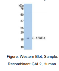 https://msimg.bioon.com/bionline/goods-no-pic.png