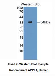 https://msimg.bioon.com/bionline/goods-no-pic.png