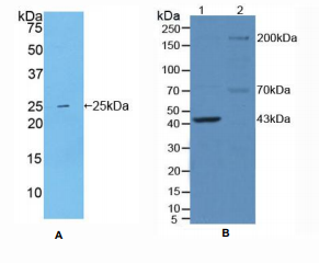 https://msimg.bioon.com/bionline/goods-no-pic.png