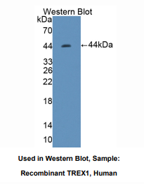 https://msimg.bioon.com/bionline/goods-no-pic.png