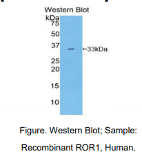 https://msimg.bioon.com/bionline/goods-no-pic.png