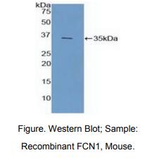 https://msimg.bioon.com/bionline/goods-no-pic.png