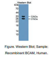 人基底细胞粘附分子(BCAM)多克隆抗体