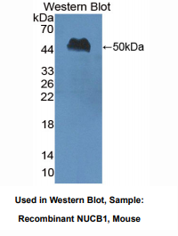 https://msimg.bioon.com/bionline/goods-no-pic.png