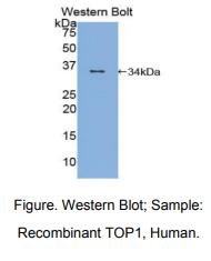 https://msimg.bioon.com/bionline/goods-no-pic.png