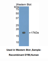 https://msimg.bioon.com/bionline/goods-no-pic.png