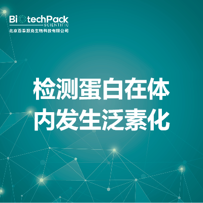 https://msimg.bioon.com/bionline/goods-no-pic.png
