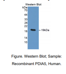 https://msimg.bioon.com/bionline/goods-no-pic.png