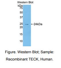 人胸腺表达趋化因子(TECK)多克隆抗体