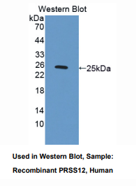 https://msimg.bioon.com/bionline/goods-no-pic.png