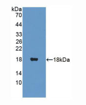 人泛酸激酶4(PANK4)多克隆抗体