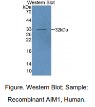 人黑素瘤缺乏因子1(AIM1)多克隆抗体