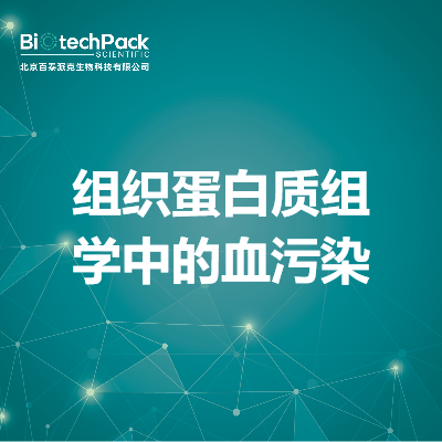 https://msimg.bioon.com/bionline/goods-no-pic.png
