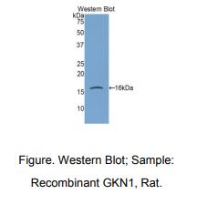 https://msimg.bioon.com/bionline/goods-no-pic.png