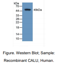 人钙腔蛋白(CALU)多克隆抗体