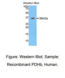 人丙酮酸脱氢酶β(PDHb)多克隆抗体