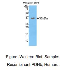 https://msimg.bioon.com/bionline/goods-no-pic.png