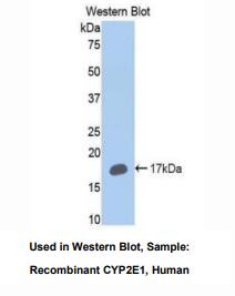 https://msimg.bioon.com/bionline/goods-no-pic.png