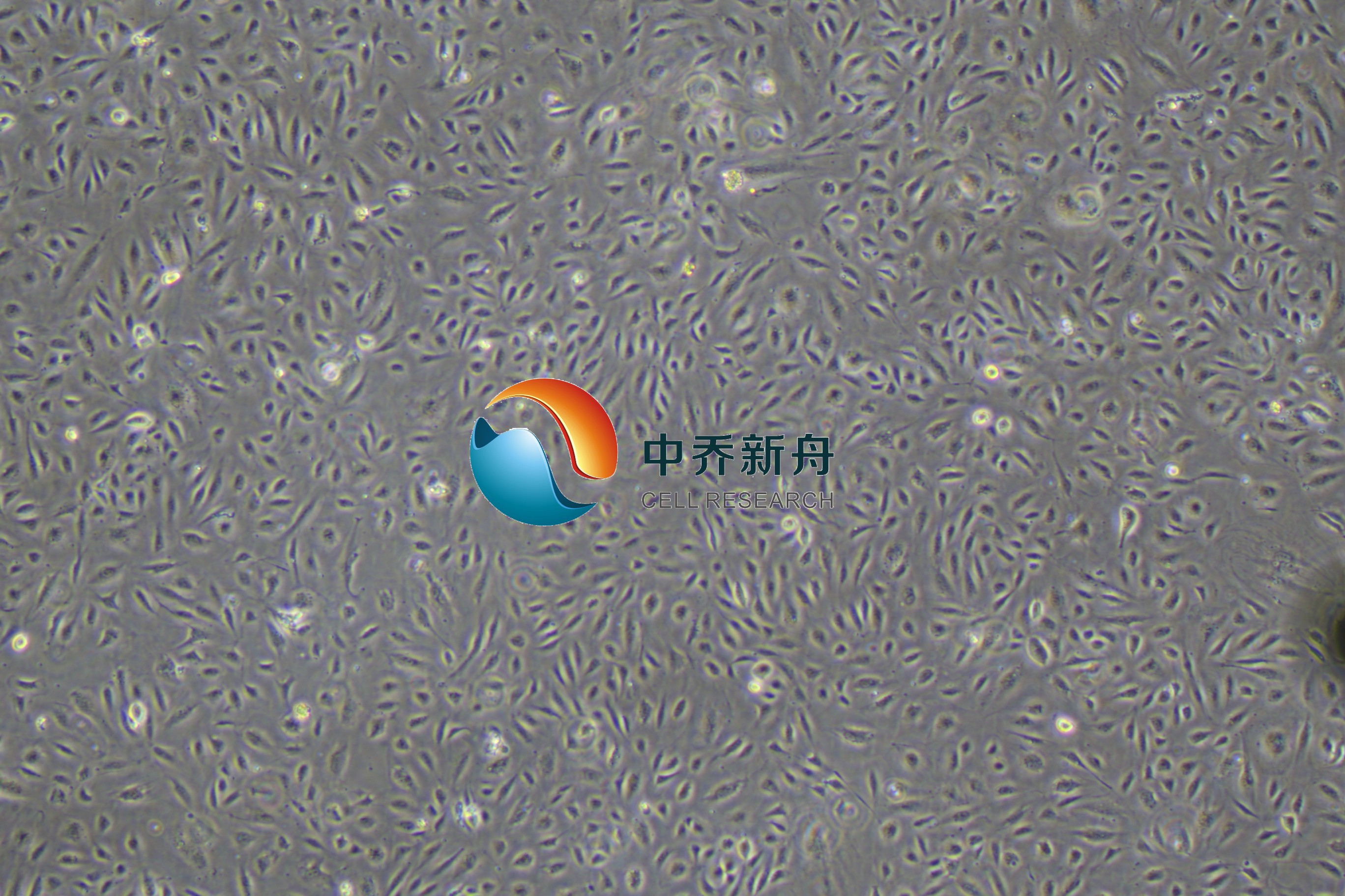 人肝窦内皮细胞永生化